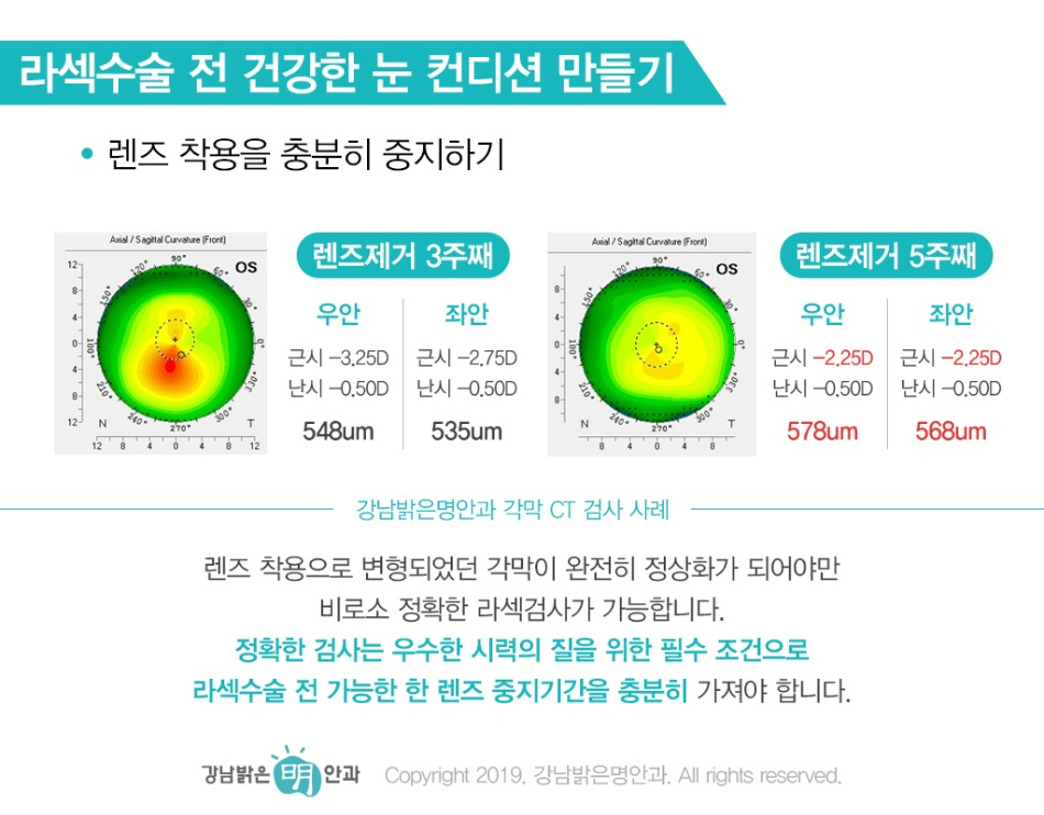 200722_강남밝은명안과_68차_칼럼일러스트3.jpg